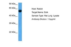 Dolichol Kinase Rabbit anti-Rat, Polyclonal, Novus Biologicals 0.1 mL | Buy Online | Novus Biologicals | Fisher Scientific